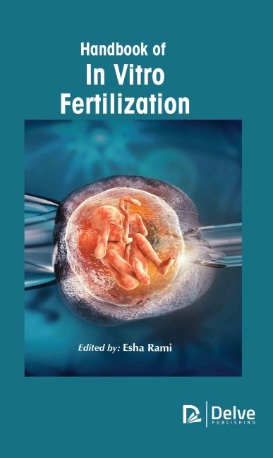 Vorderes Coverbild Handbook of in Vitro Fertilization