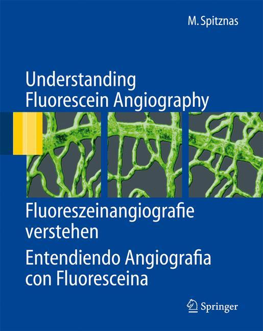 Vorderes Coverbild Understanding Fluorescein Angiography, Fluoreszeinangiografie verstehen, Entendiendo Angiografía con Fluoresceína