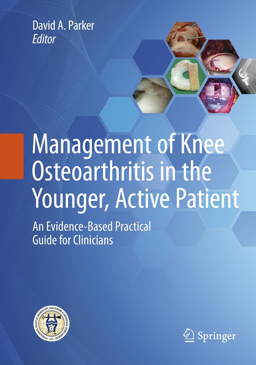 Vorderes Coverbild Management of Knee Osteoarthritis in the Younger, Active Patient