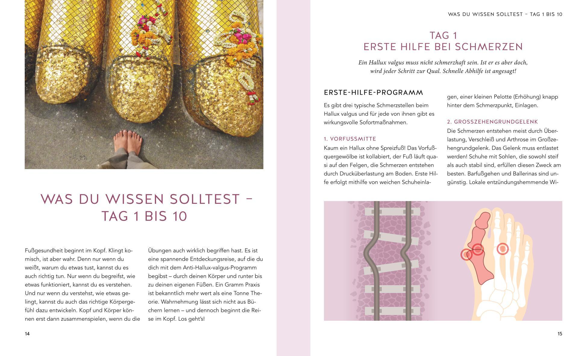 Beispielinhalt (Bild) Hallux valgus