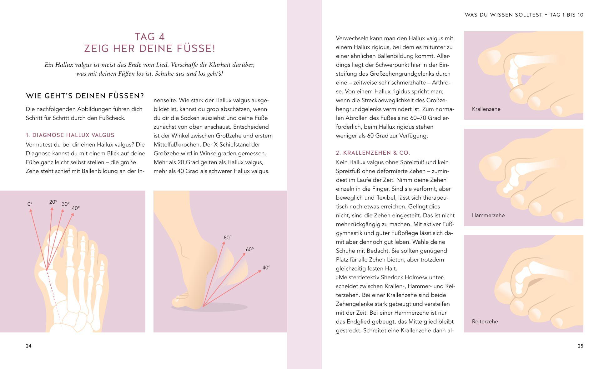 Beispielinhalt (Bild) Hallux valgus