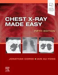 Vorderes Coverbild Chest X-Ray Made Easy