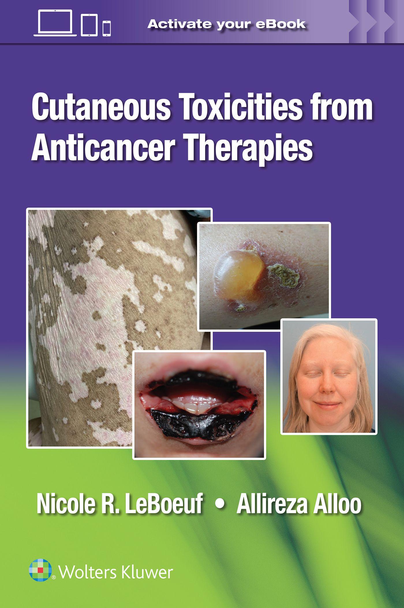 Vorderes Coverbild Cutaneous Toxicities from Anticancer Therapies