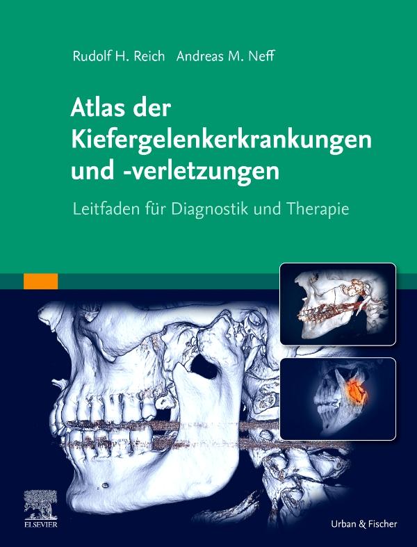 Vorderes Coverbild Atlas der Kiefergelenkerkrankungen und -verletzungen