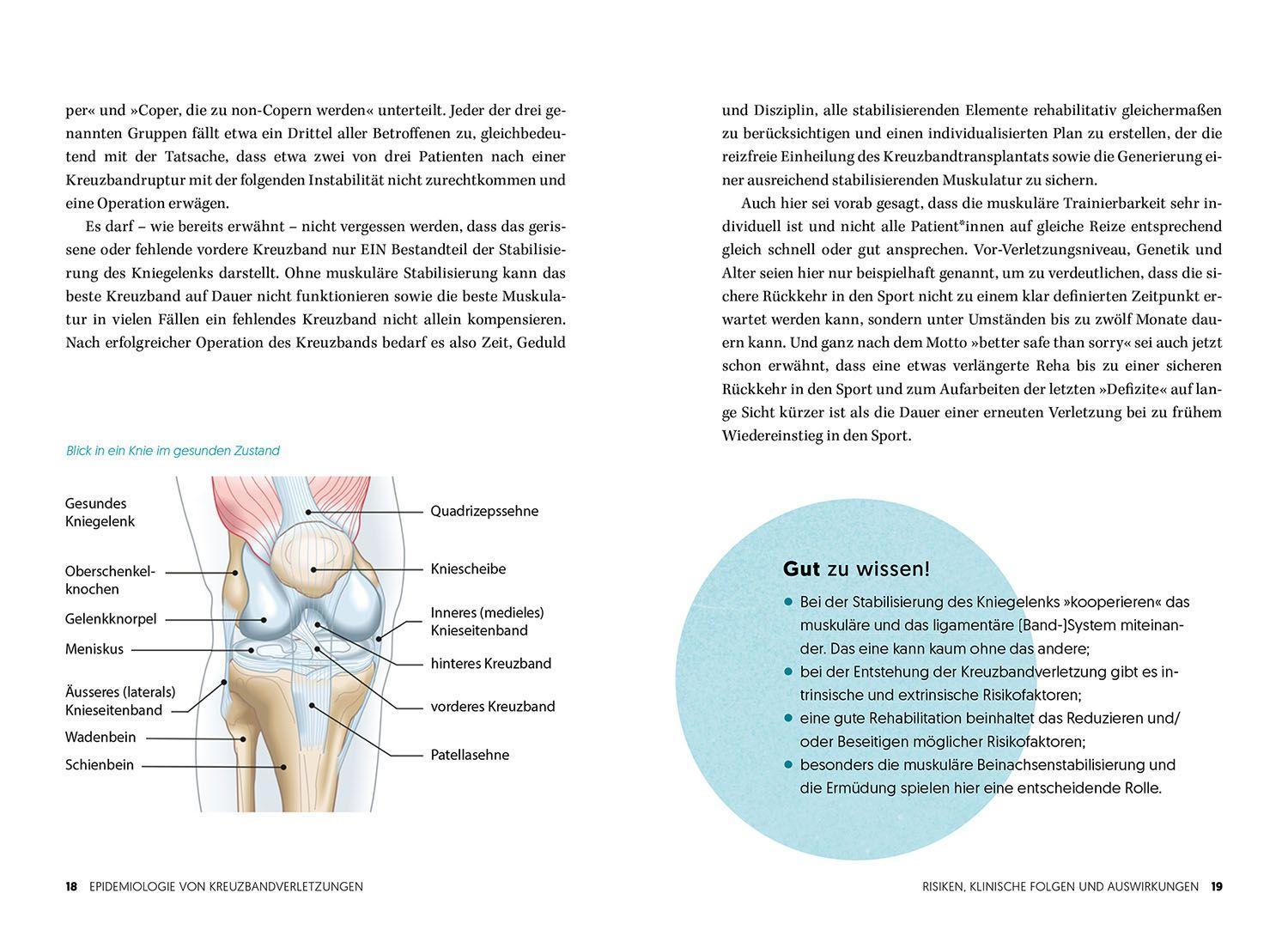 Beispielinhalt (Bild) Wieder fit nach dem Kreuzbandriss
