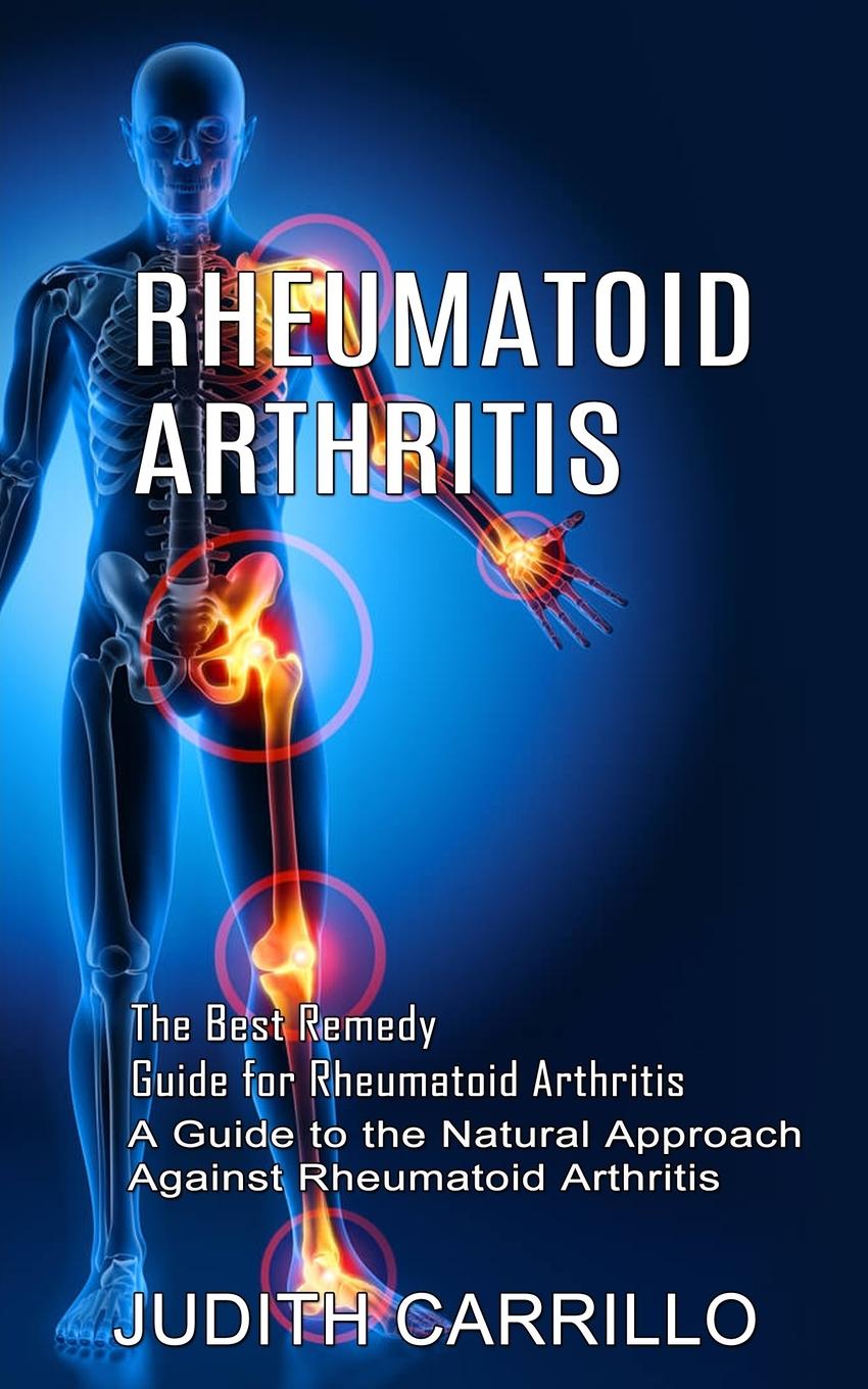 Vorderes Coverbild Rheumatoid Arthritis