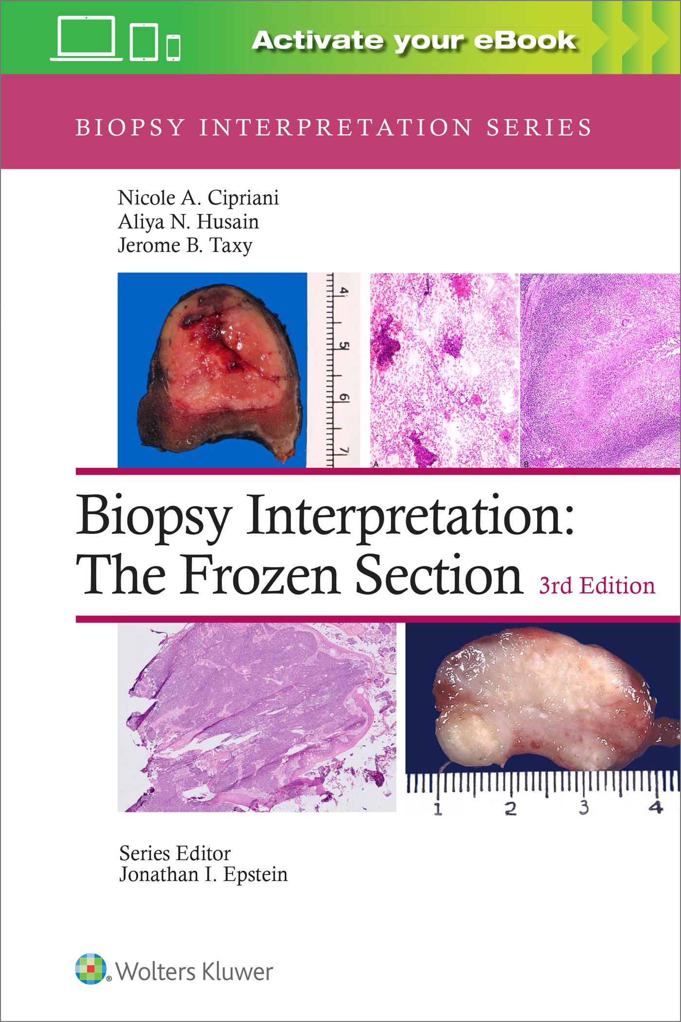 Vorderes Coverbild Biopsy Interpretation: The Frozen Section: Print + eBook with Multimedia