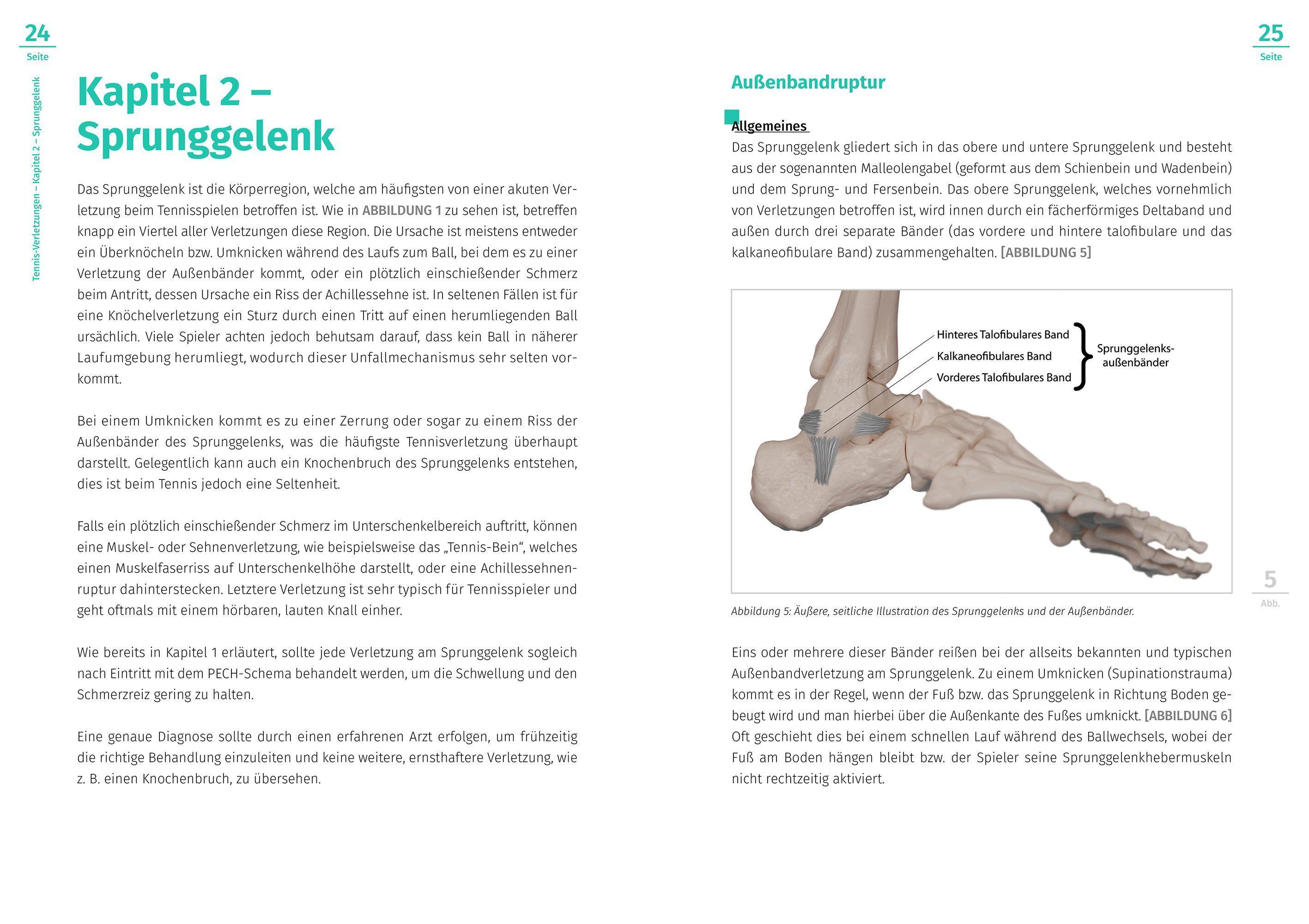Beispielinhalt (Bild) Tennis-Verletzungen