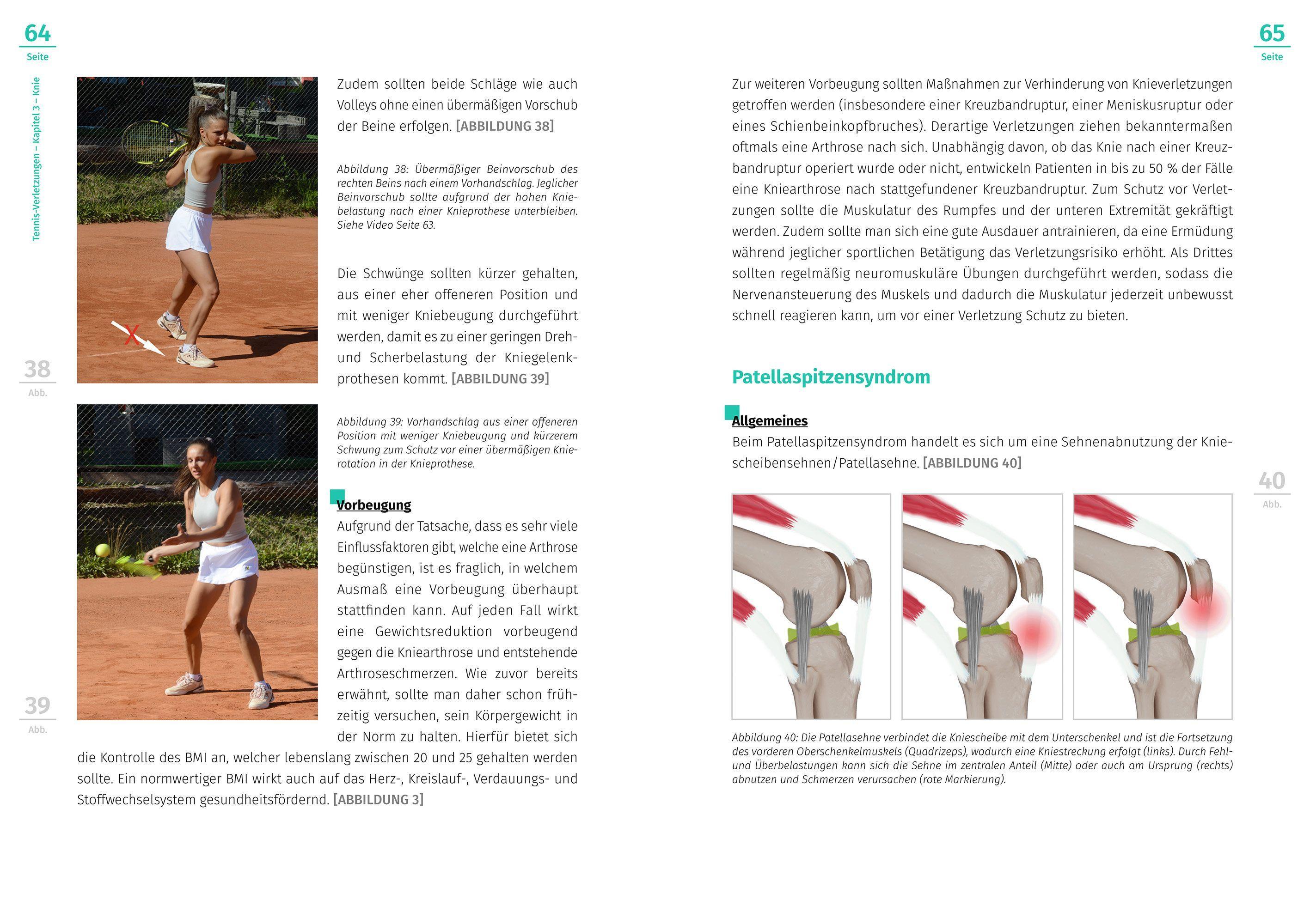 Beispielinhalt (Bild) Tennis-Verletzungen