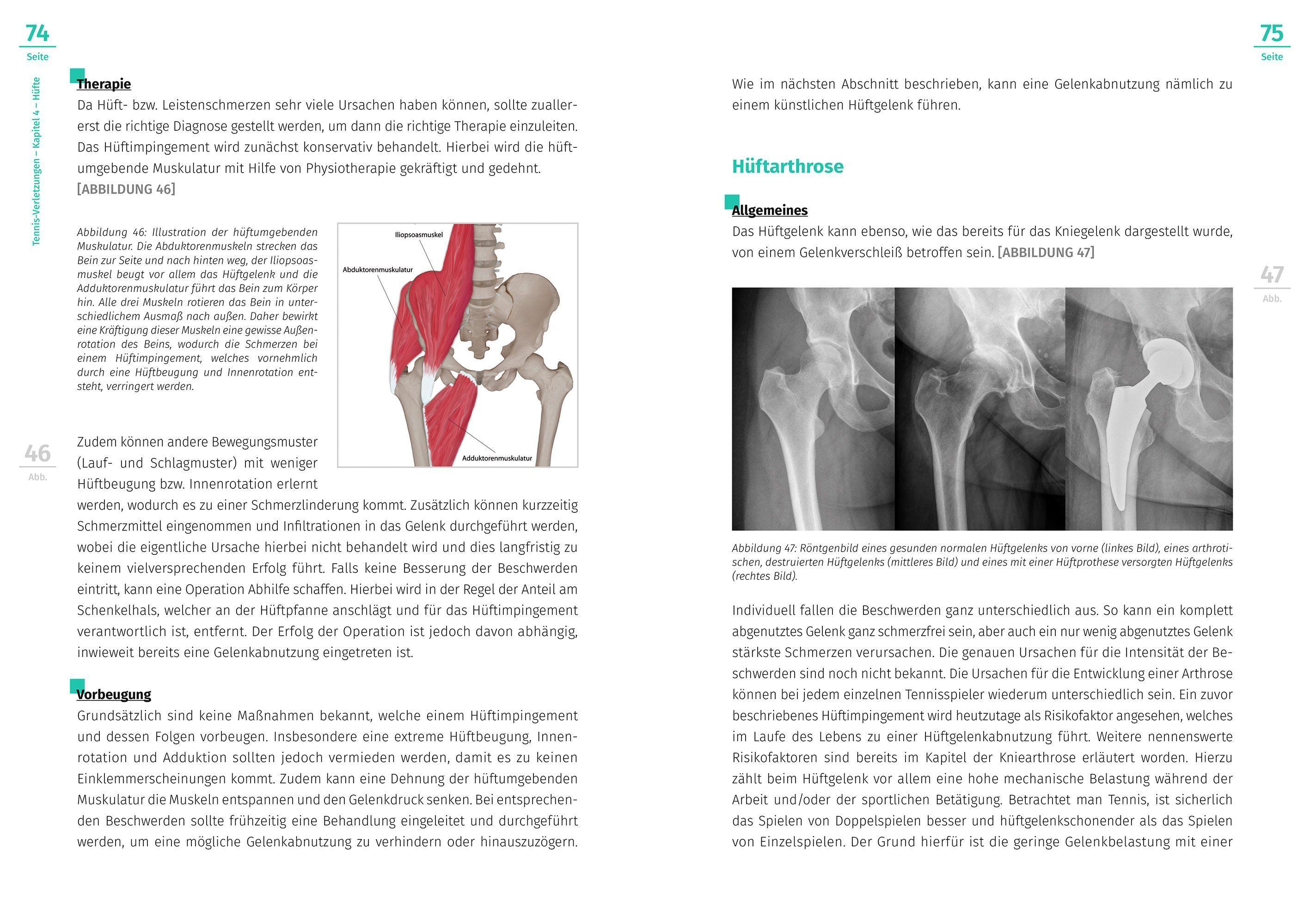 Beispielinhalt (Bild) Tennis-Verletzungen