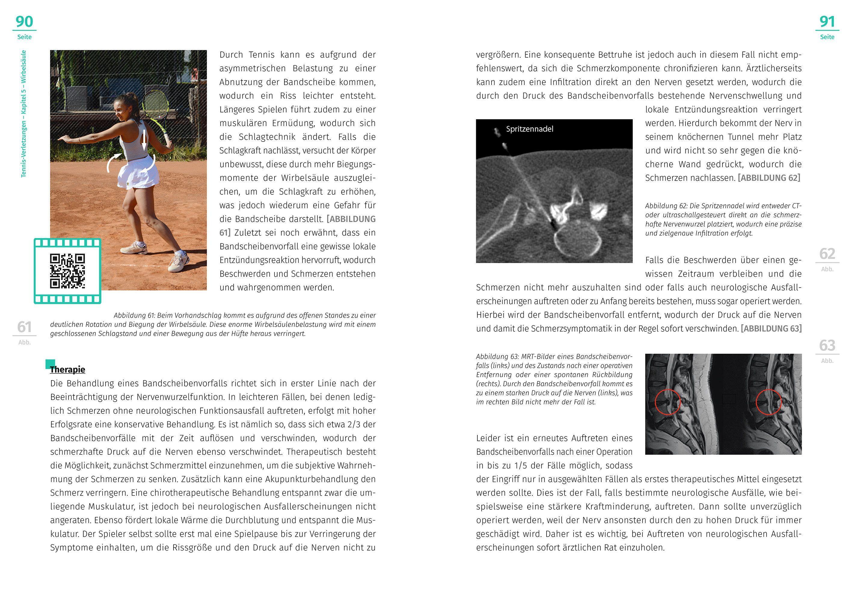 Beispielinhalt (Bild) Tennis-Verletzungen
