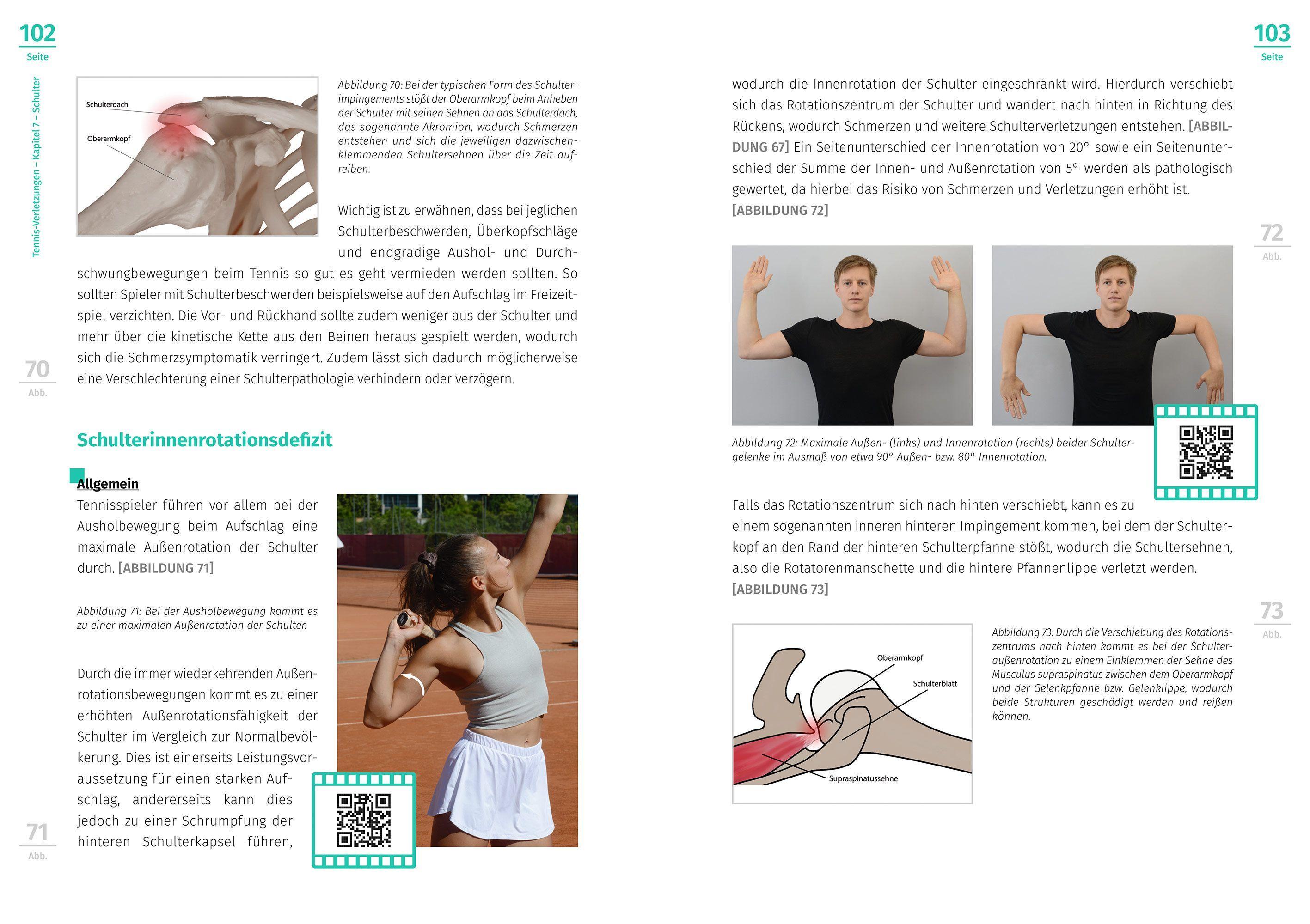 Beispielinhalt (Bild) Tennis-Verletzungen