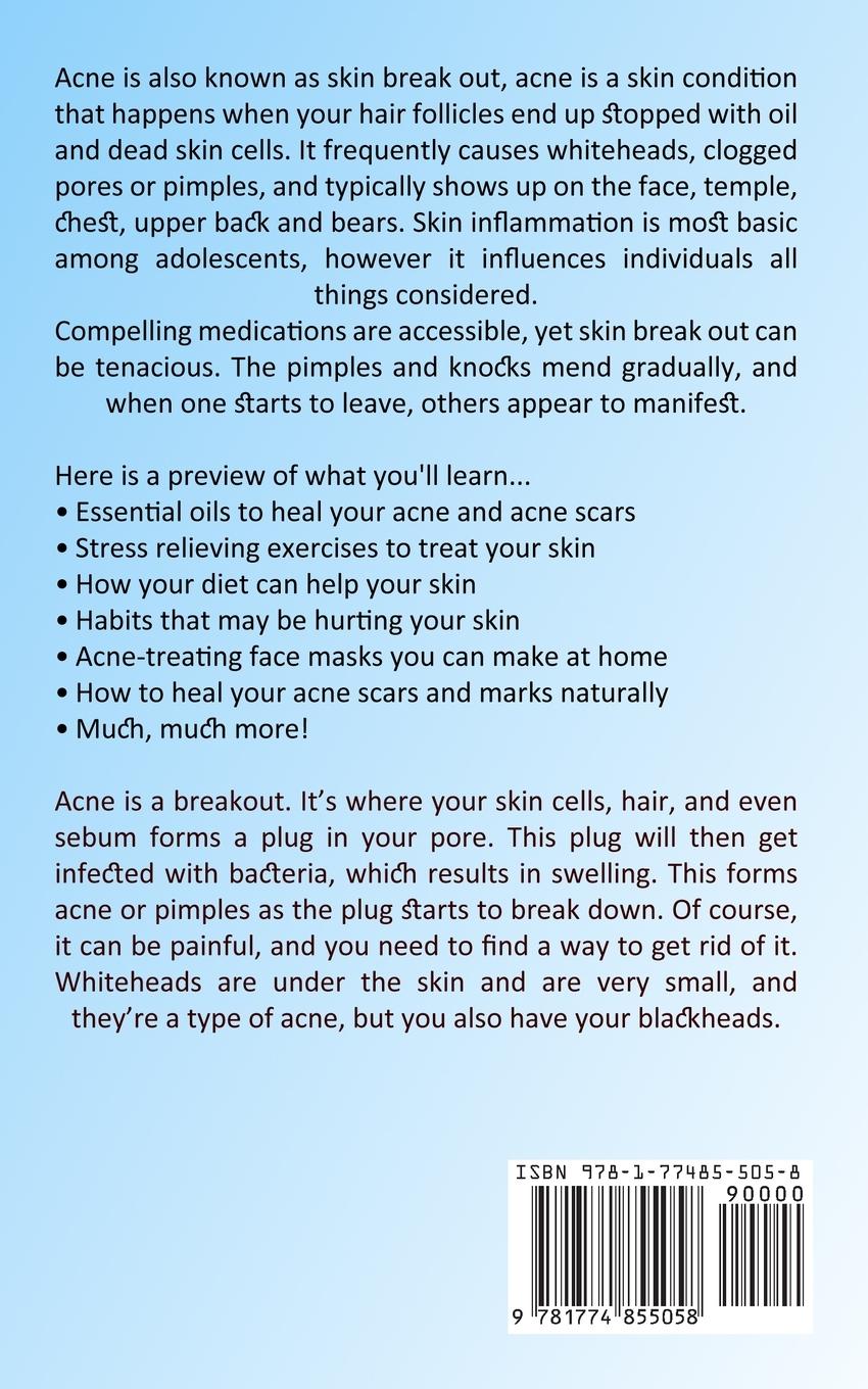 Rückseitencover Acne