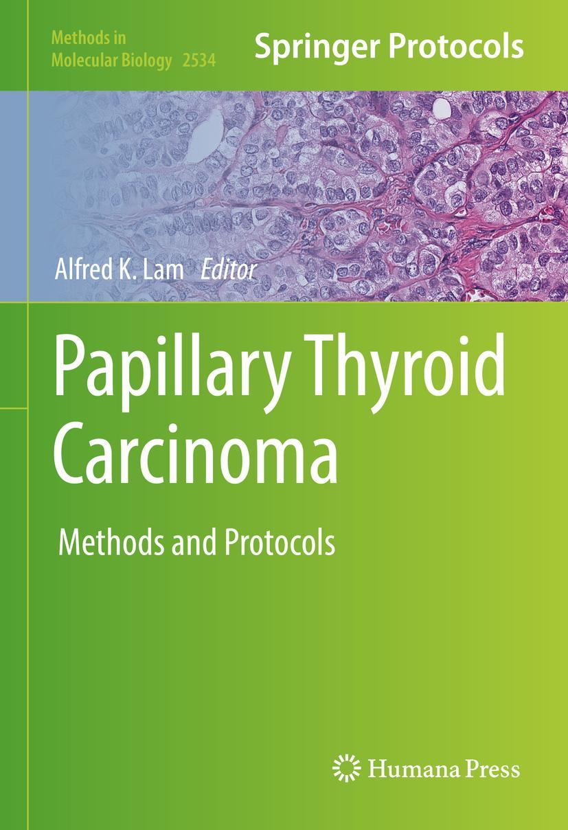 Vorderes Coverbild Papillary Thyroid Carcinoma