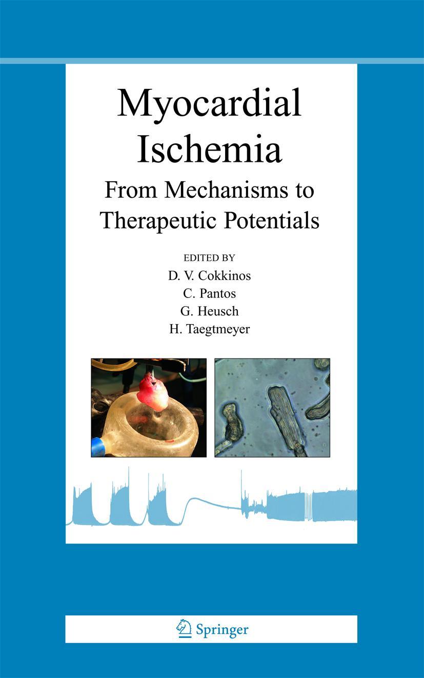 Vorderes Coverbild Myocardial Ischemia