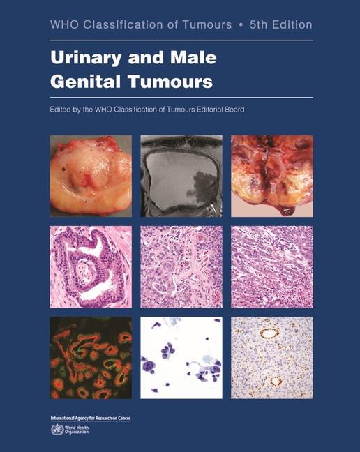Vorderes Coverbild Urinary and Male Genital Tumours