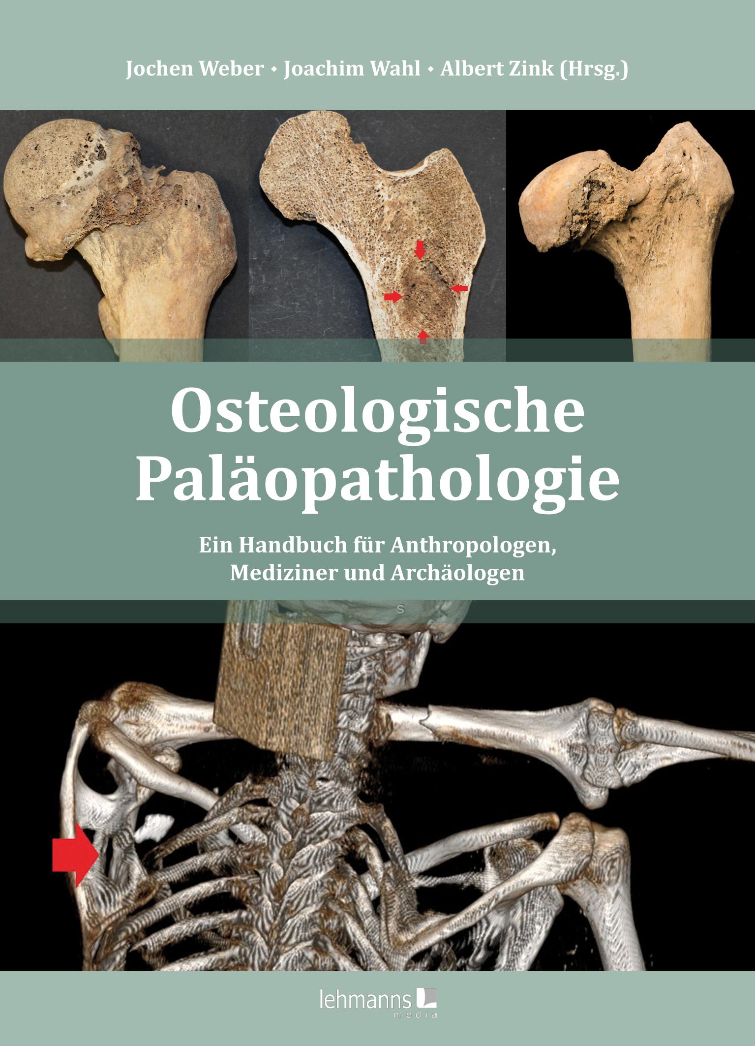 Vorderes Coverbild Osteologische Paläopathologie