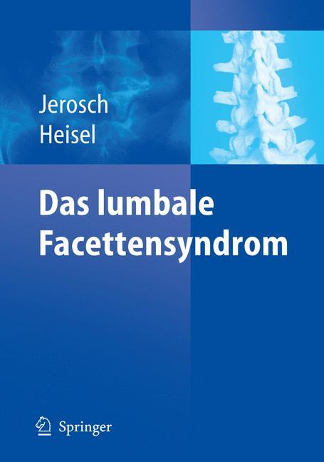Vorderes Coverbild Das lumbale Facettensyndrom
