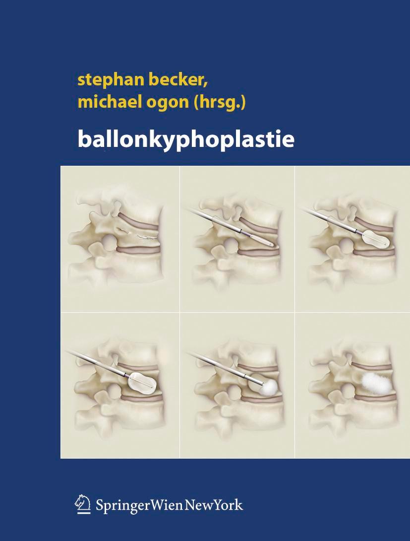 Vorderes Coverbild Ballonkyphoplastie