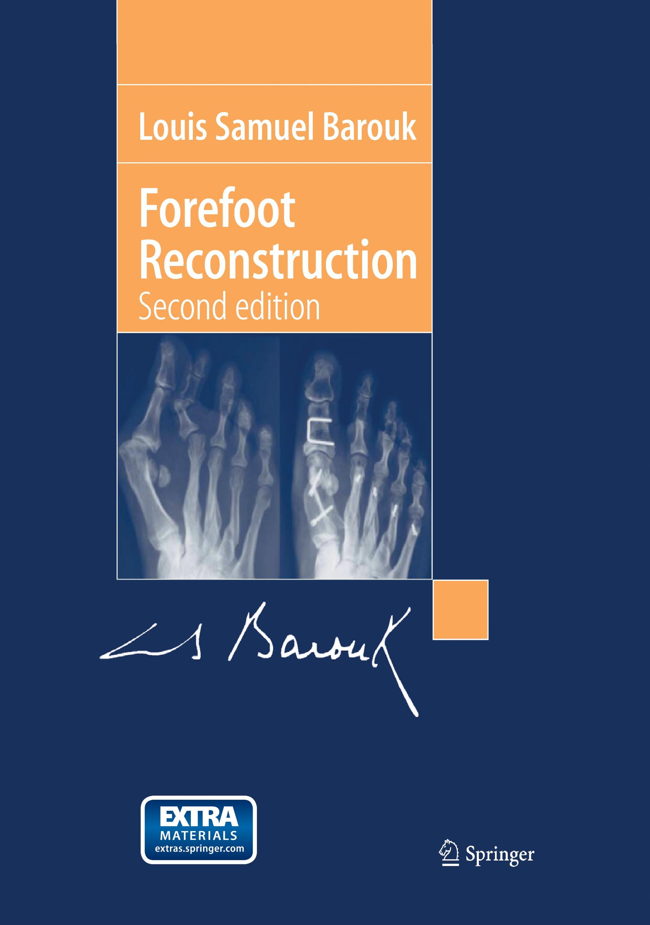 Vorderes Coverbild Forefoot Reconstruction