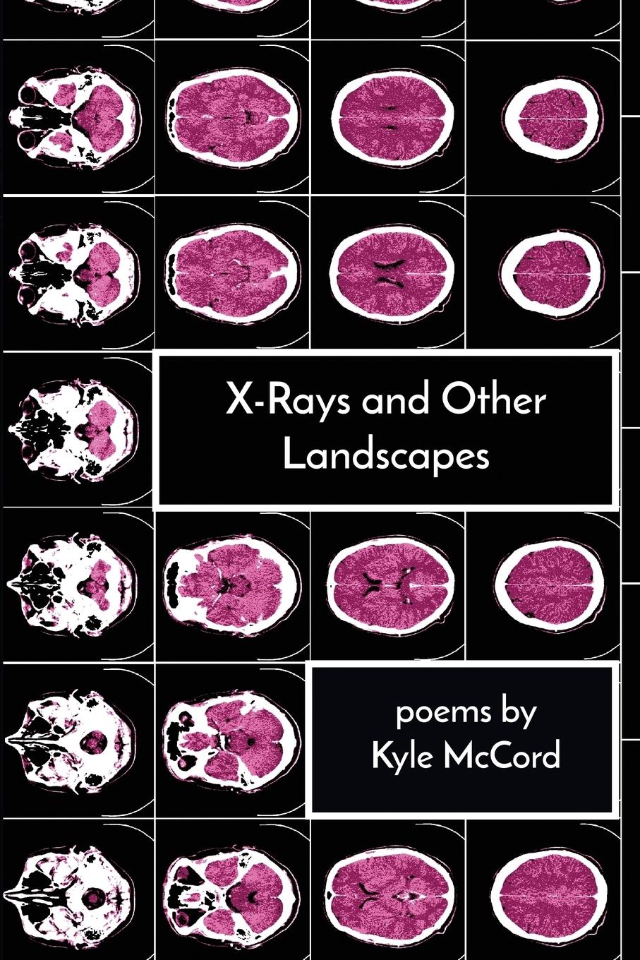 Vorderes Coverbild X-Rays and Other Landscapes