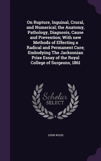 Vorderes Coverbild On Rupture, Inguinal, Crural, and Numerical; the Anatomy, Pathology, Diagnosis, Cause and Prevention; With new Methods of Effecting a Radical and Perm