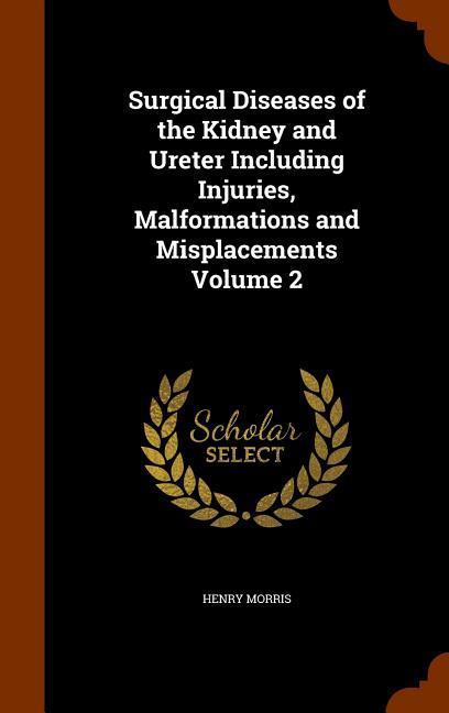 Vorderes Coverbild Surgical Diseases of the Kidney and Ureter Including Injuries, Malformations and Misplacements Volume 2