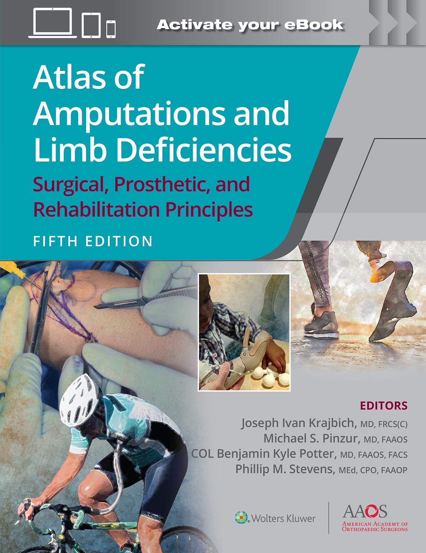 Vorderes Coverbild Atlas of Amputations and Limb Deficiencies