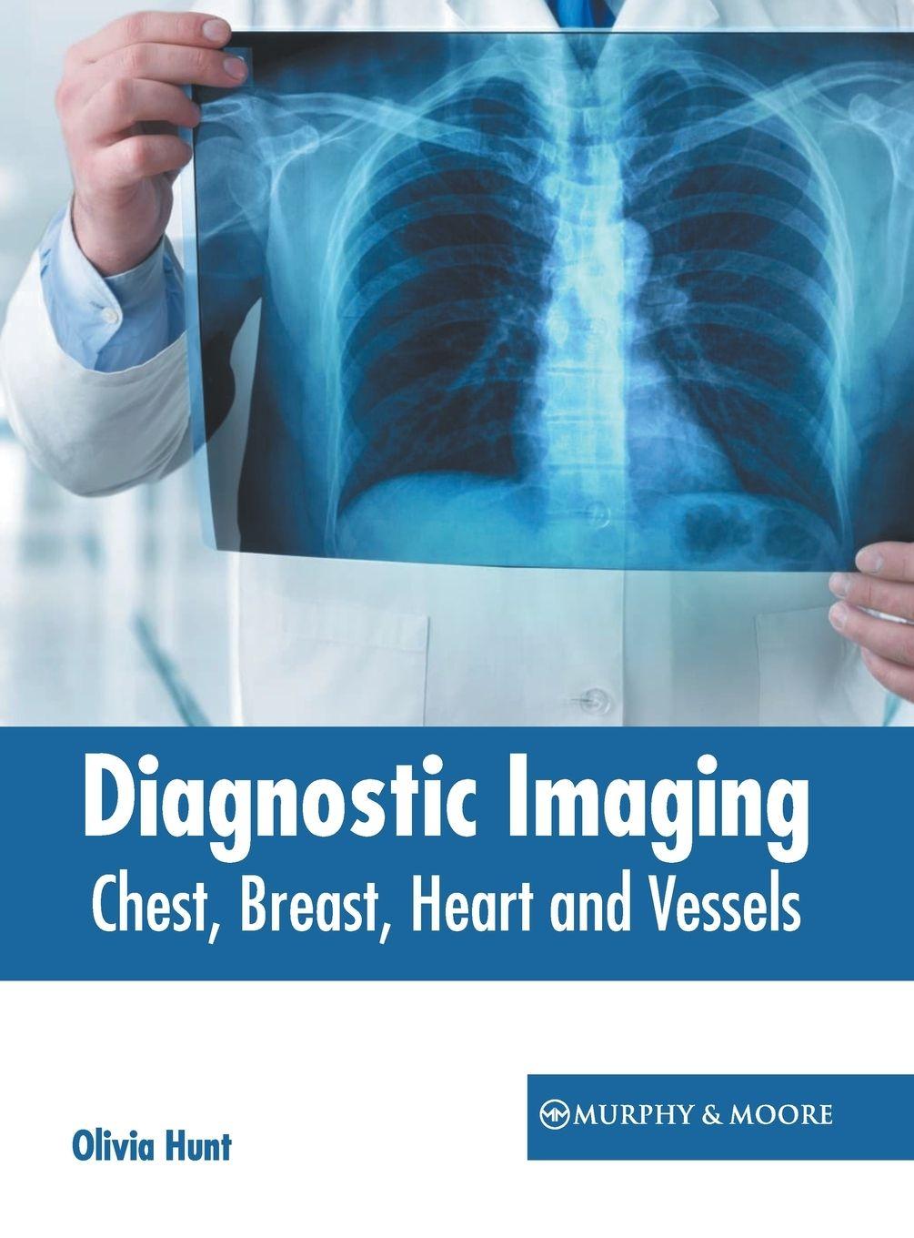 Vorderes Coverbild Diagnostic Imaging: Chest, Breast, Heart and Vessels