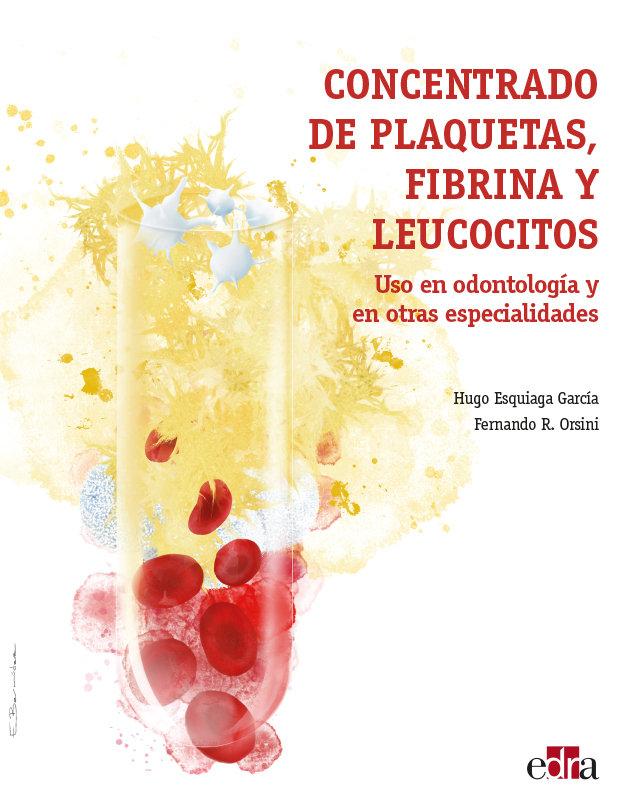 Vorderes Coverbild Concentrado de Plaquetas, Fibrina Y Leucocitos. USO En Odontología Y En Otras Especialidades