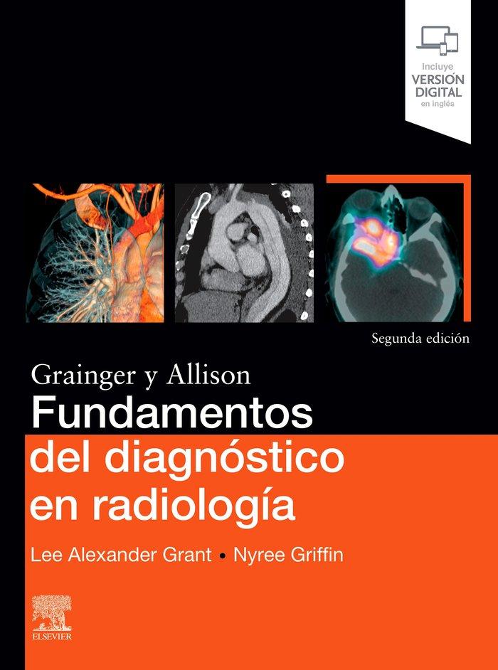 Vorderes Coverbild Fundamentos del diagnóstico en radiología