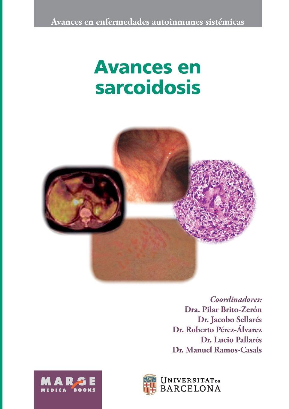 Vorderes Coverbild Avances en sarcoidosis