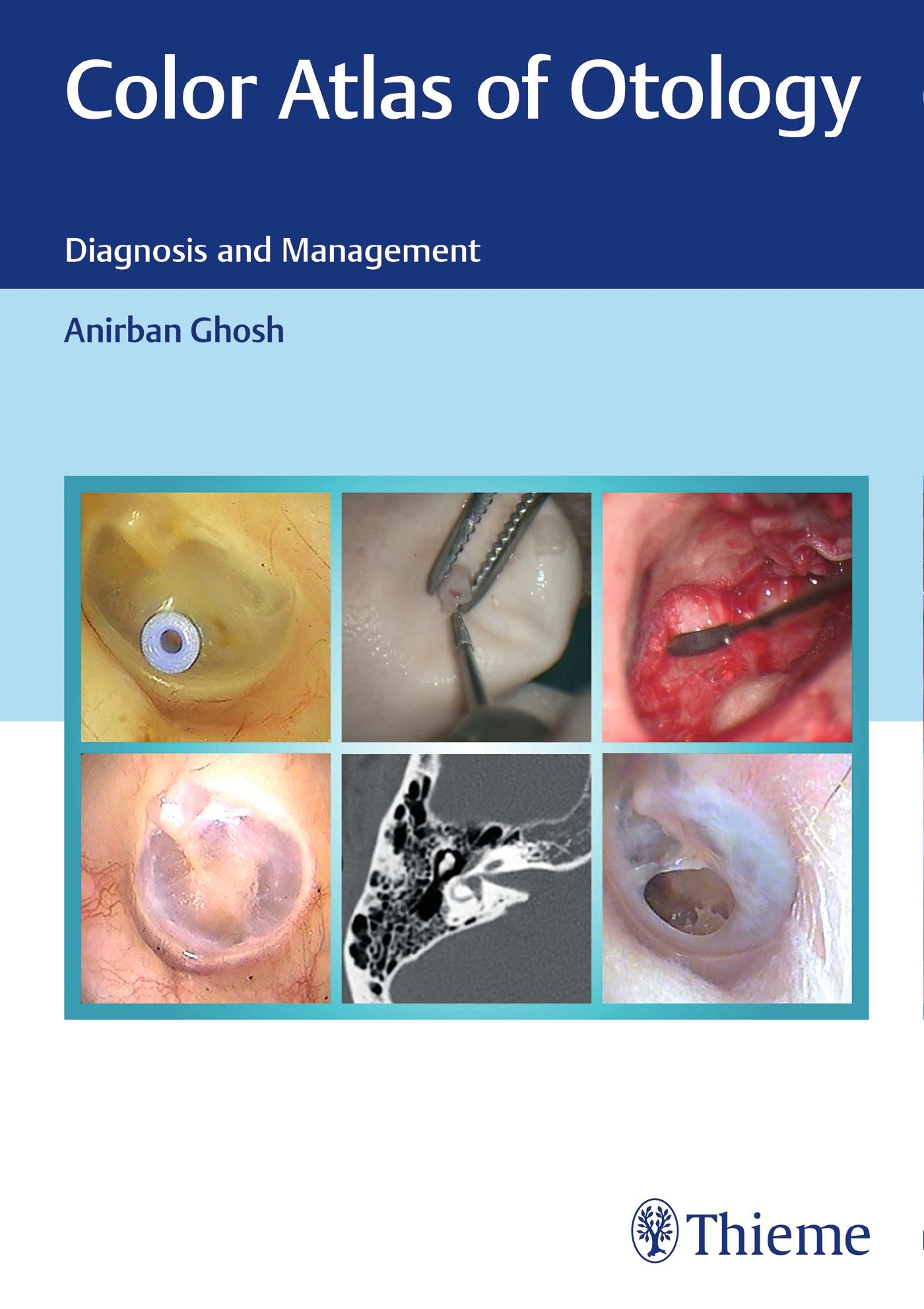 Vorderes Coverbild Color Atlas of Otology
