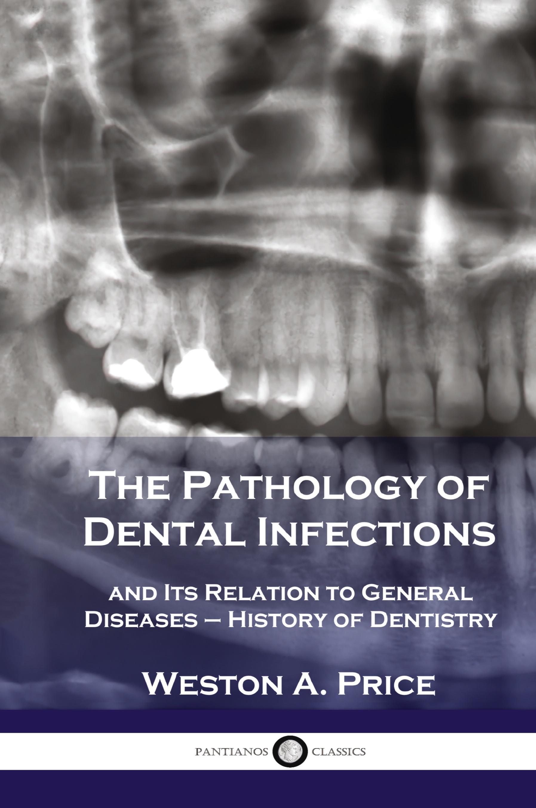 Vorderes Coverbild Pathology of Dental Infections