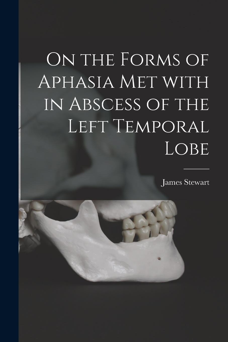 Vorderes Coverbild On the Forms of Aphasia Met With in Abscess of the Left Temporal Lobe [microform]