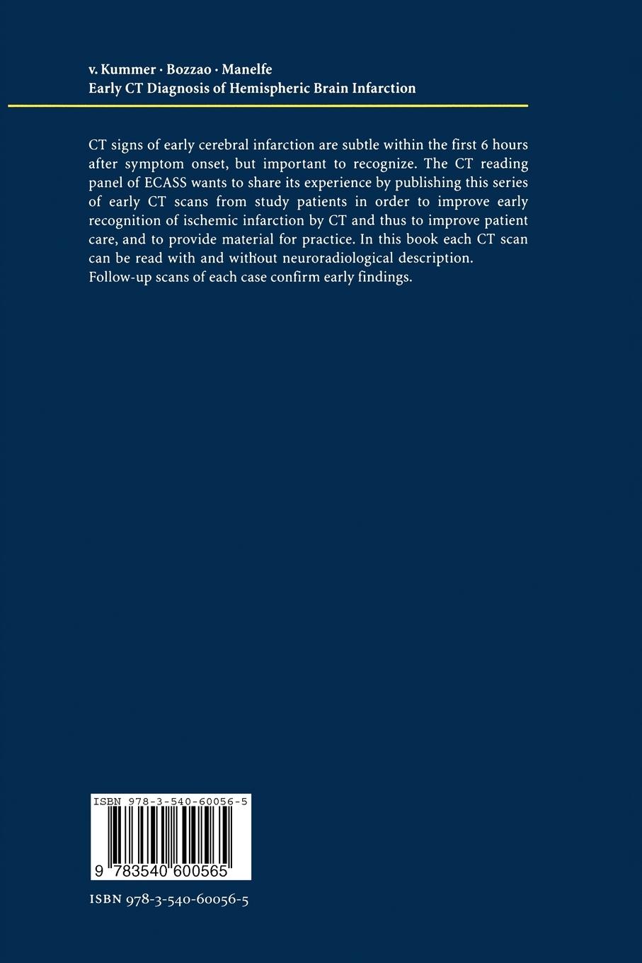 Rückseitencover Early CT Diagnosis of Hemispheric Brain Infarction