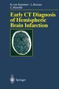 Vorderes Coverbild Early CT Diagnosis of Hemispheric Brain Infarction