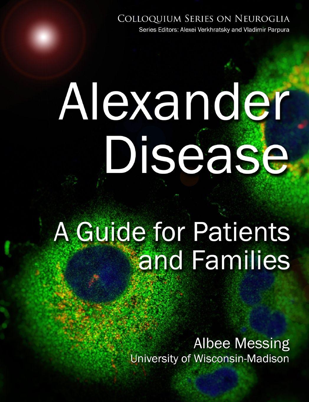 Vorderes Coverbild Alexander Disease