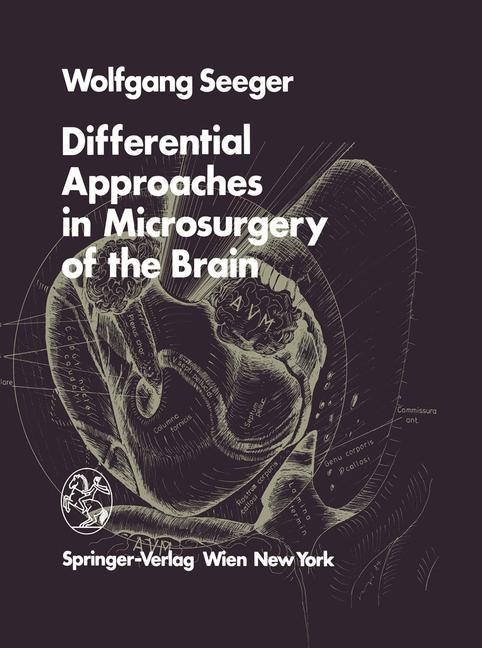 Vorderes Coverbild Differential Approaches in Microsurgery of the Brain