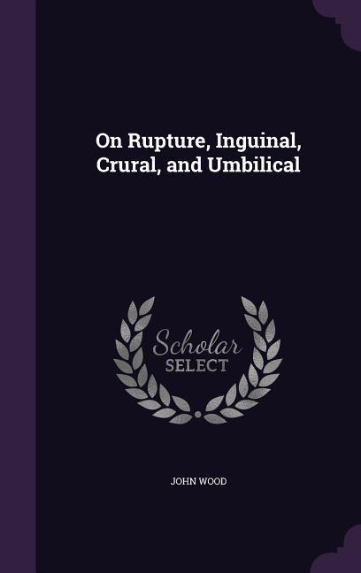 Vorderes Coverbild On Rupture, Inguinal, Crural, and Umbilical