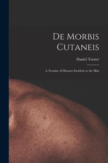 Vorderes Coverbild De Morbis Cutaneis: a Treatise of Diseases Incident to the Skin