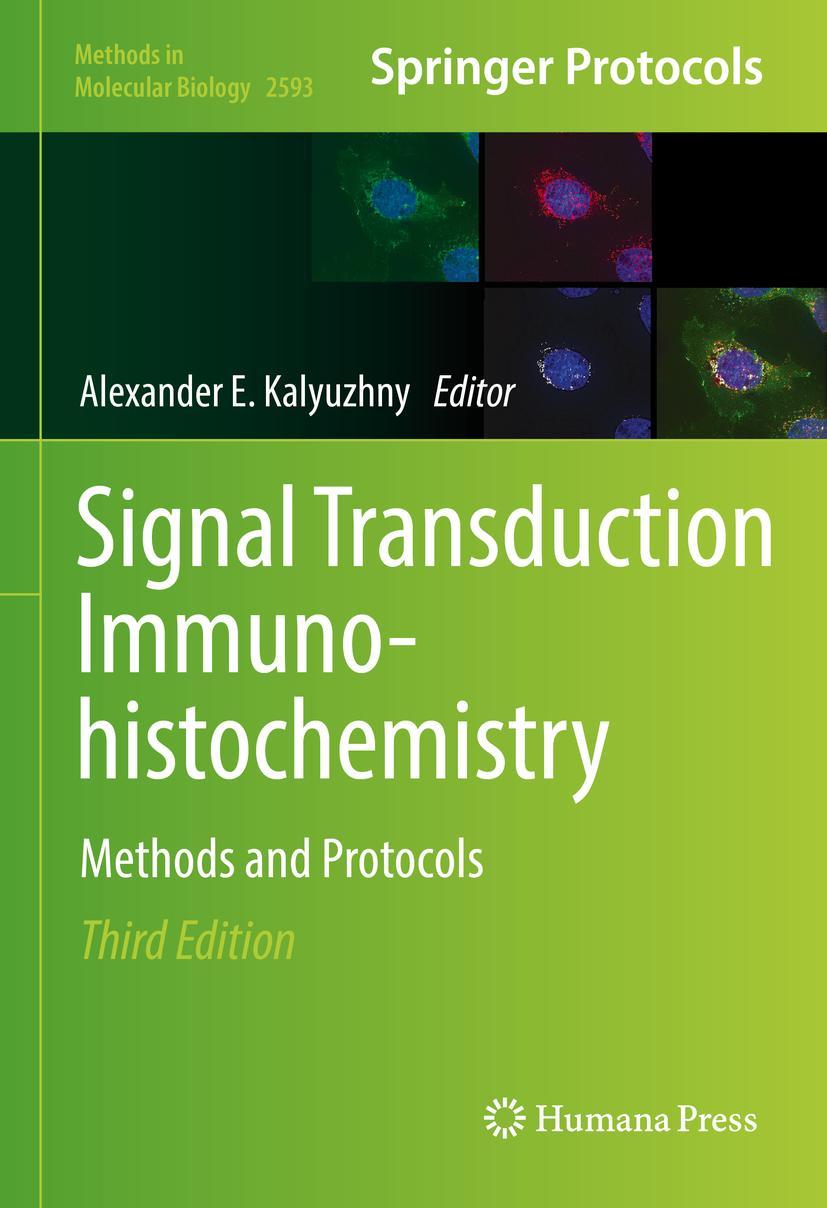 Vorderes Coverbild Signal Transduction Immunohistochemistry
