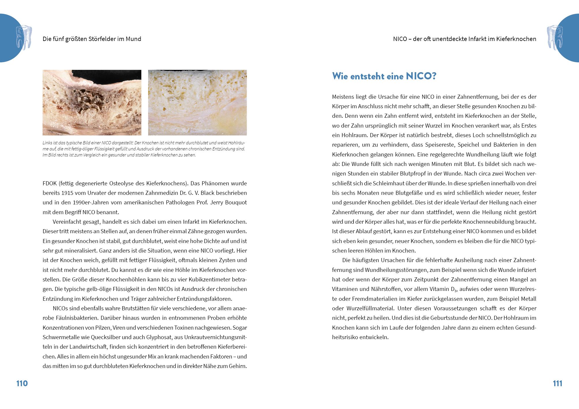 Beispielinhalt (Bild) Die geheime Kraft der Zähne