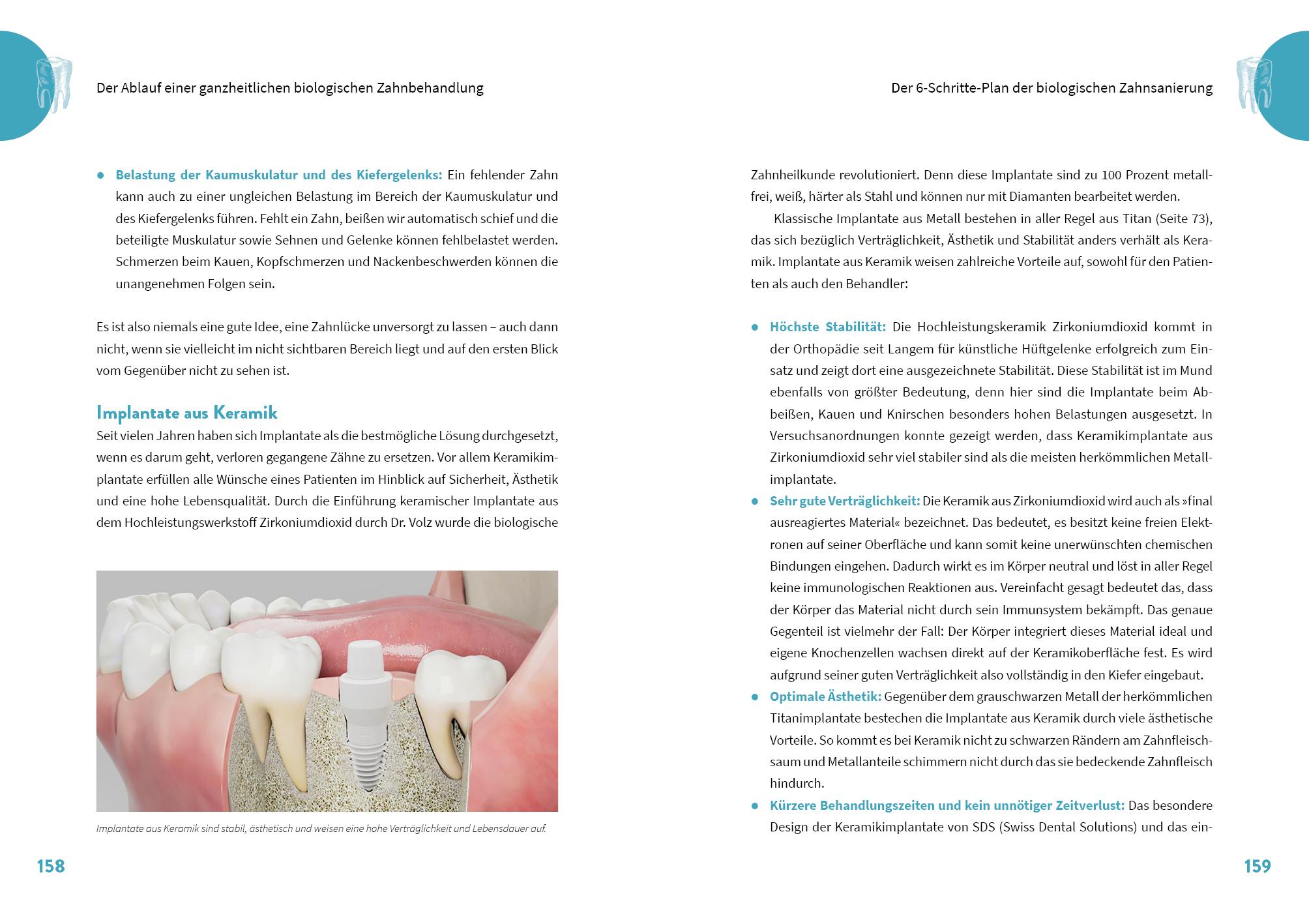 Beispielinhalt (Bild) Die geheime Kraft der Zähne