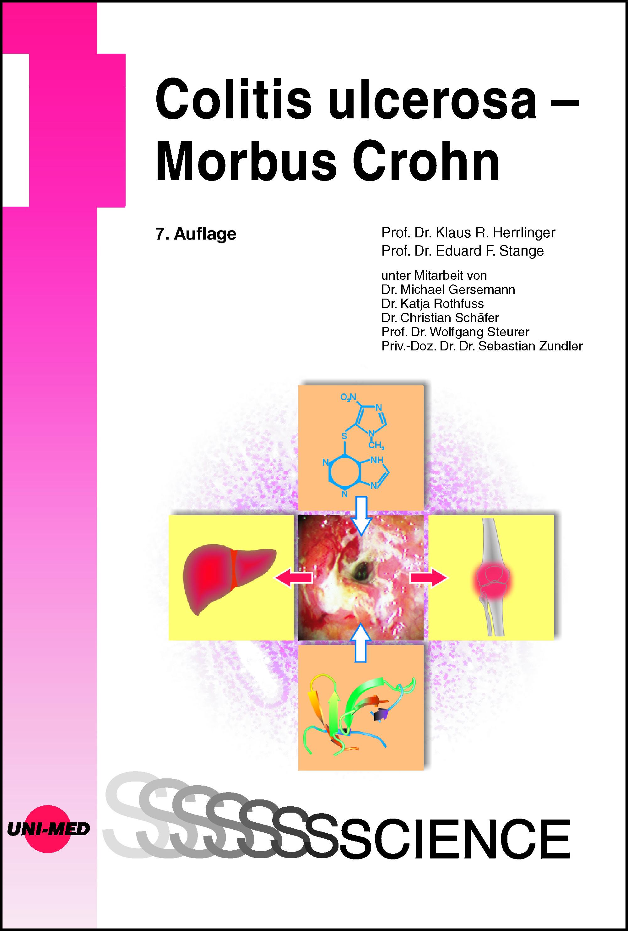 Vorderes Coverbild Colitis ulcerosa - Morbus Crohn