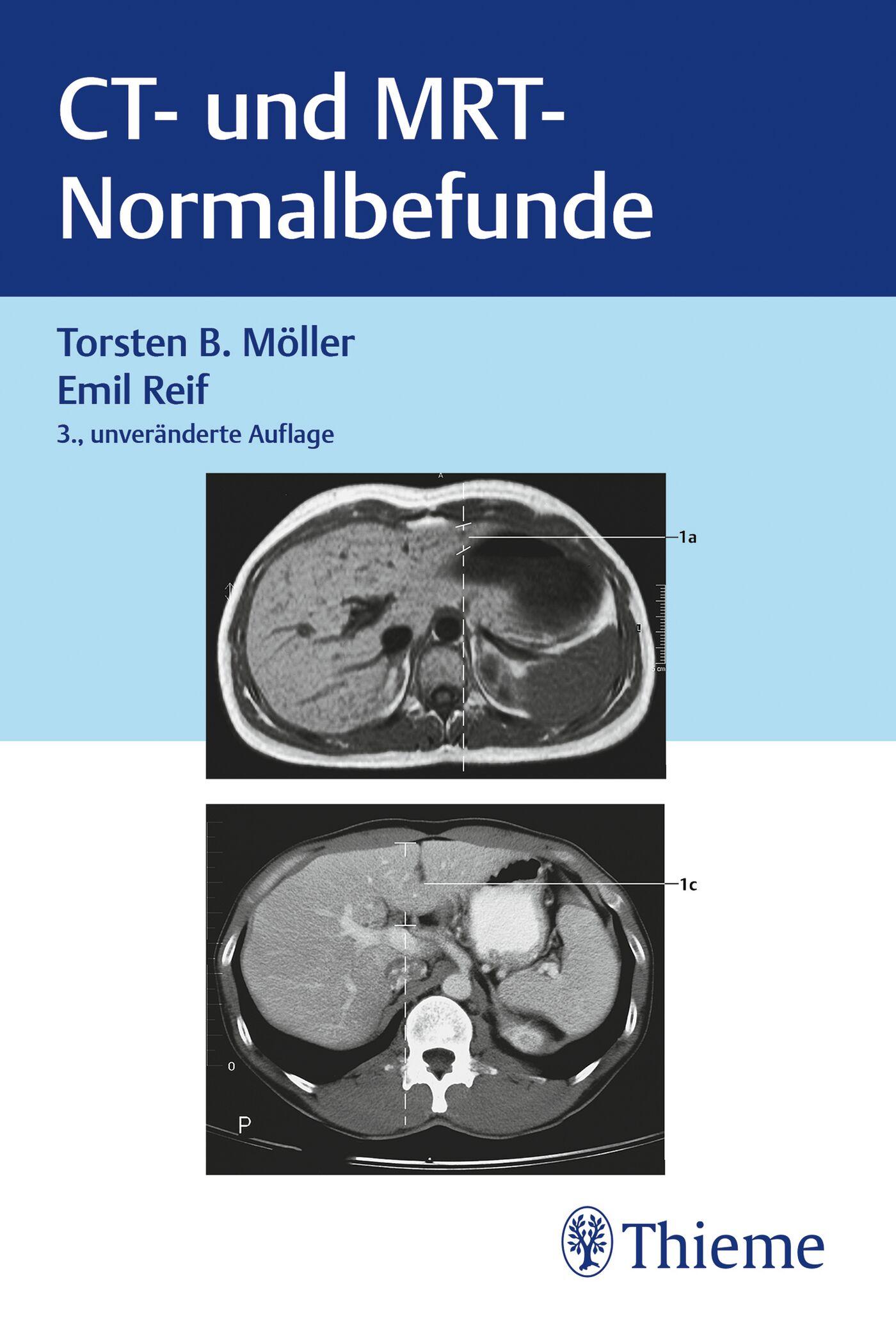 Vorderes Coverbild CT und MRT Normalbefunde