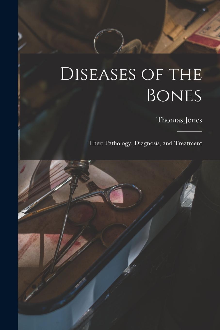 Vorderes Coverbild Diseases of the Bones: Their Pathology, Diagnosis, and Treatment