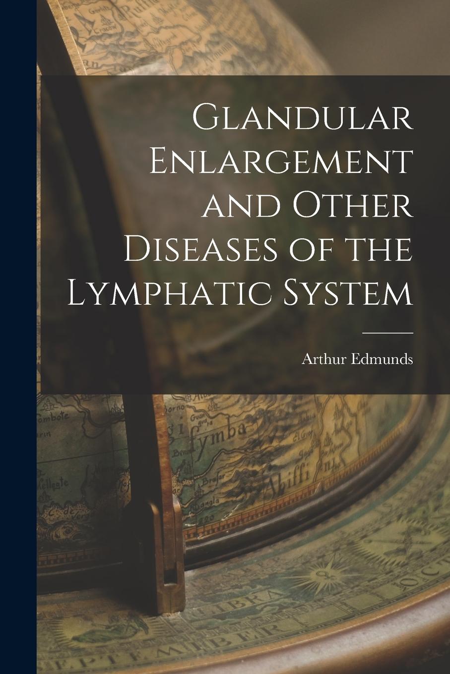 Vorderes Coverbild Glandular Enlargement and Other Diseases of the Lymphatic System