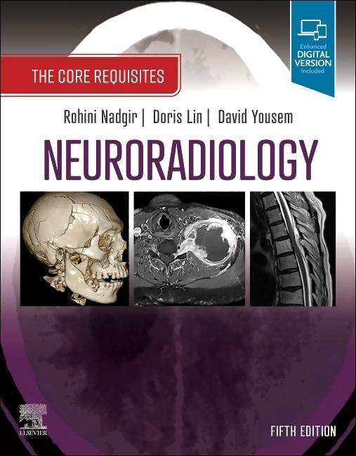 Vorderes Coverbild Neuroradiology