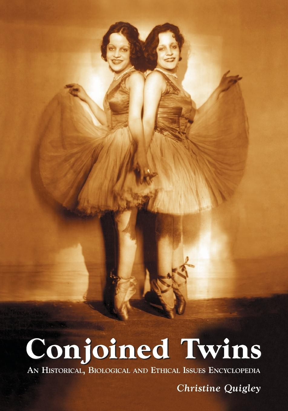 Vorderes Coverbild Conjoined Twins